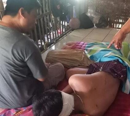 Korban pembacokan gerombolan pemotor di Ujunggenteng di dampingi orang tuanya usai mendapat perawatan medis. (XJabar)